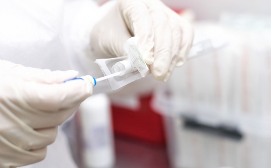 “唾液検査”で虫歯菌を確認