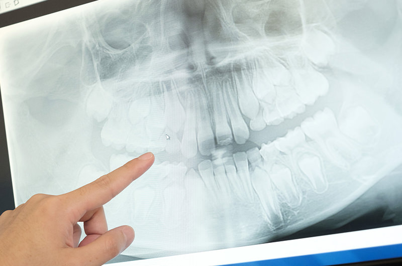 普段は気づけない病気を見逃さないために